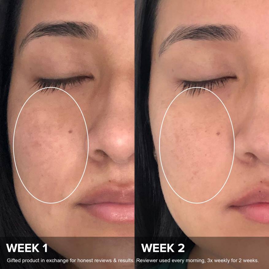 6RJ4130 pełny Leczenie niacynamidem 20%. Paula's Choice