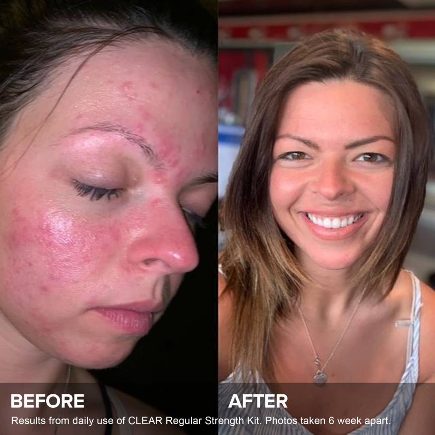 6RJ48 3-etapowa rutyna dodatkowy zestaw wzmacniający Paula's Choice